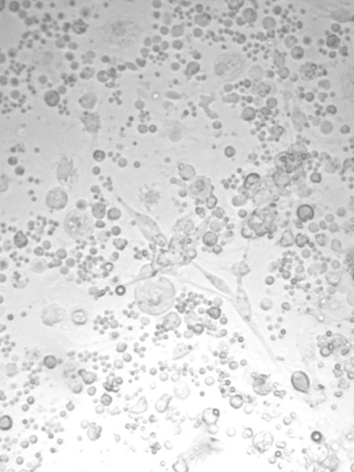 Preadipocytes isolated after seeding of common carp