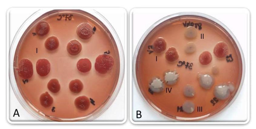 Figure-2.Morphotypes from different strains of Escherichia coli, isolated from cows milk with mastitis  (72 h of incubation at 37 C): rdar morphotypes (A); rdar, bdar, saw and mucoid morphotypes (B)  .jpg
